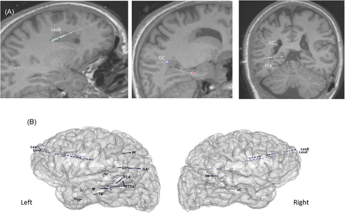 Details are in the caption following the image Details are in the caption following the image
