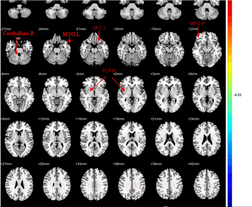 Details are in the caption following the image Details are in the caption following the image