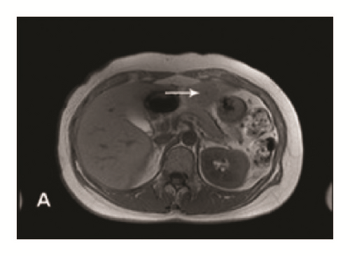 Details are in the caption following the image