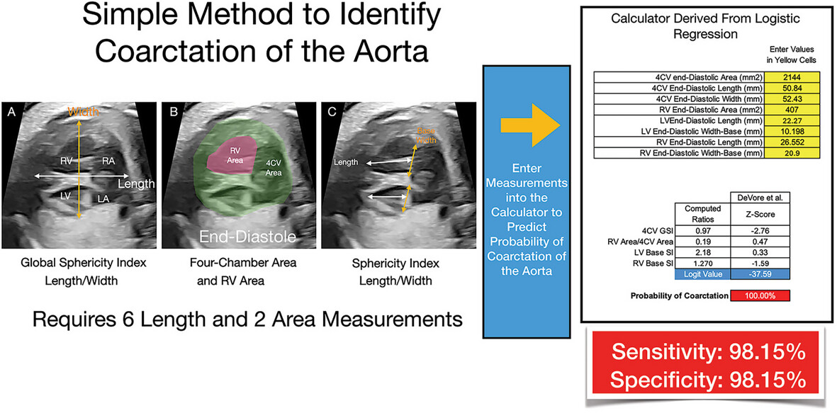 A New Method Using the Four-Chamber View to Identify Fetuses With Subsequently Confirmed Postnatal Aortic Coarctation