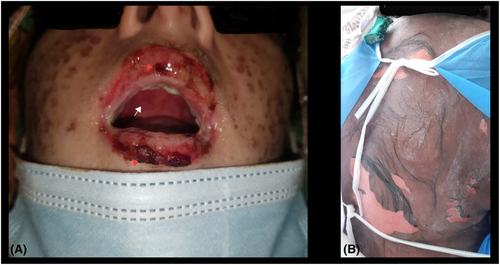 Details are in the caption following the image Details are in the caption following the image