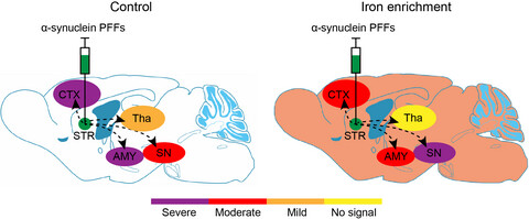 Iron reduces the propagation of pathological α-synuclein