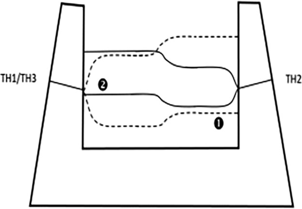 On-Line Estimation of Liquid Levels in the Blast Furnace Hearth