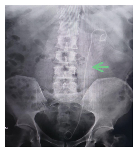 Details are in the caption following the image