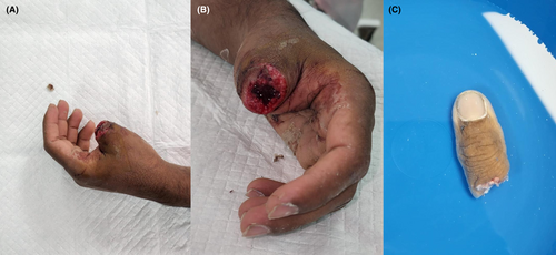 Details are in the caption following the image Details are in the caption following the image