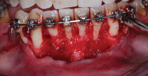 Details are in the caption following the image Details are in the caption following the image