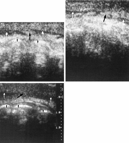 Details are in the caption following the image