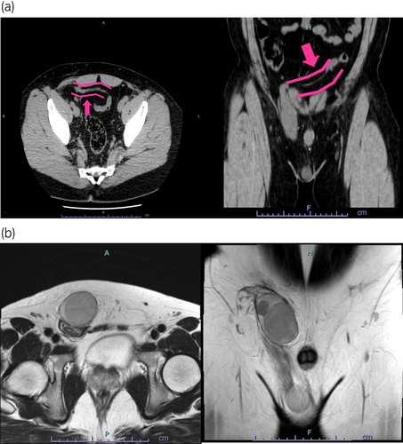 Details are in the caption following the image Details are in the caption following the image