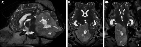 Clinical and magnetic resonance imaging findings of a cerebellar medulloblastoma in a heifer