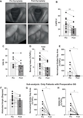 Quantitative Evaluation of Vocal Bowing Following Bilateral Thyroplasty in Age-Related Vocal Atrophy