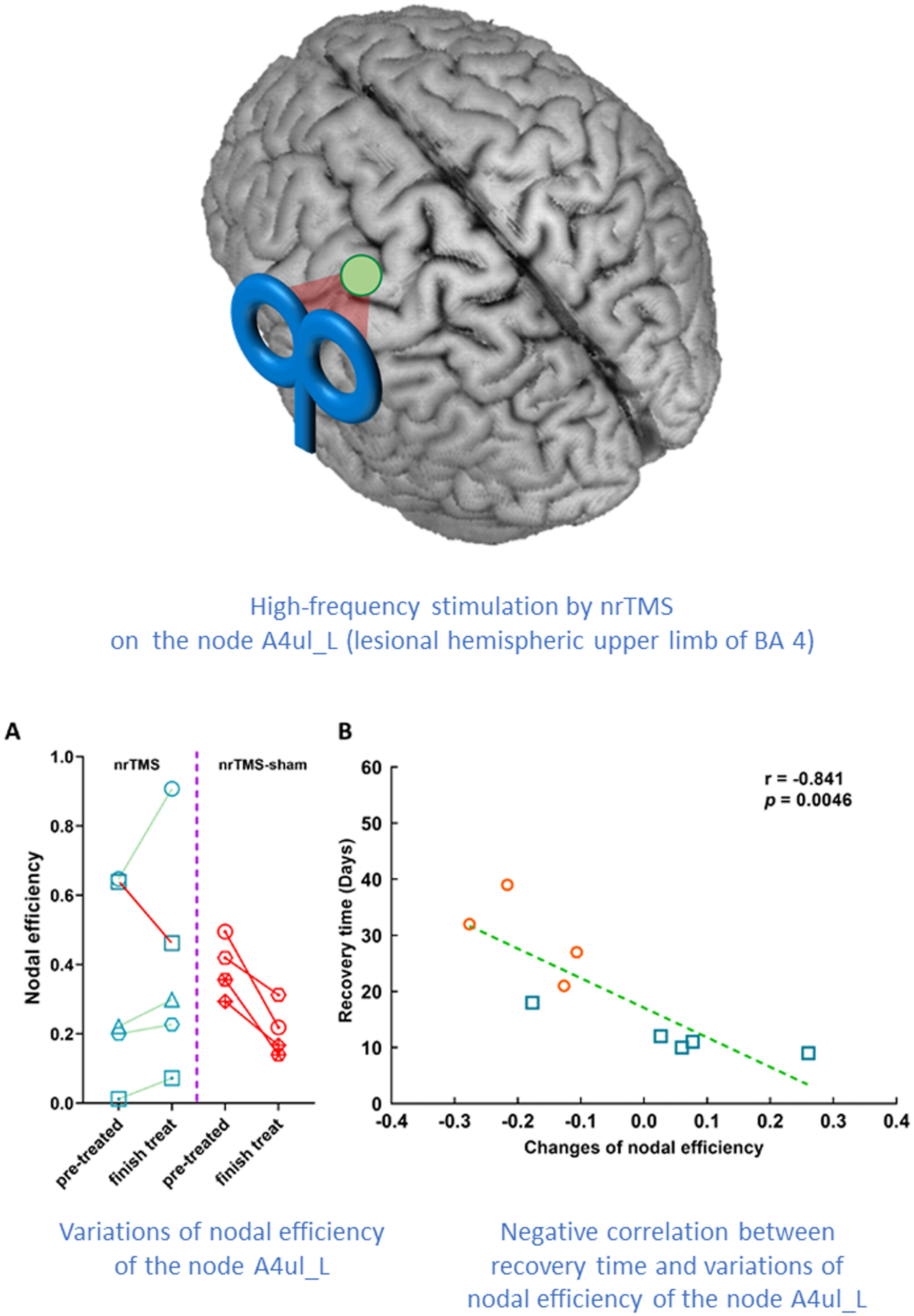 Postoperative Nodal Efficiency of the Lesional-Hemispheric Hand Motor Area Increasing Potentially Facilitated Motor Recovery for SMA Syndrome