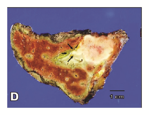 Details are in the caption following the image