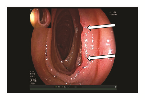 Details are in the caption following the image Details are in the caption following the image