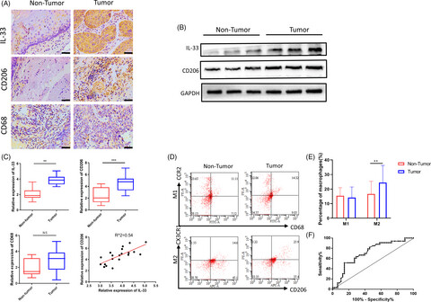 Oesophageal squamous cell carcinoma–associated IL-33 rewires macrophage polarization towards M2 via activating ornithine decarboxylase
