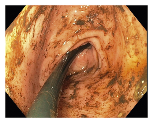 Details are in the caption following the image Details are in the caption following the image
