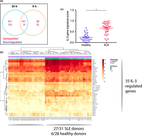 A potential association between IL-3 and type I and III interferons in systemic lupus erythematosus
