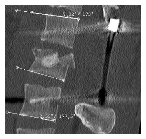 Details are in the caption following the image