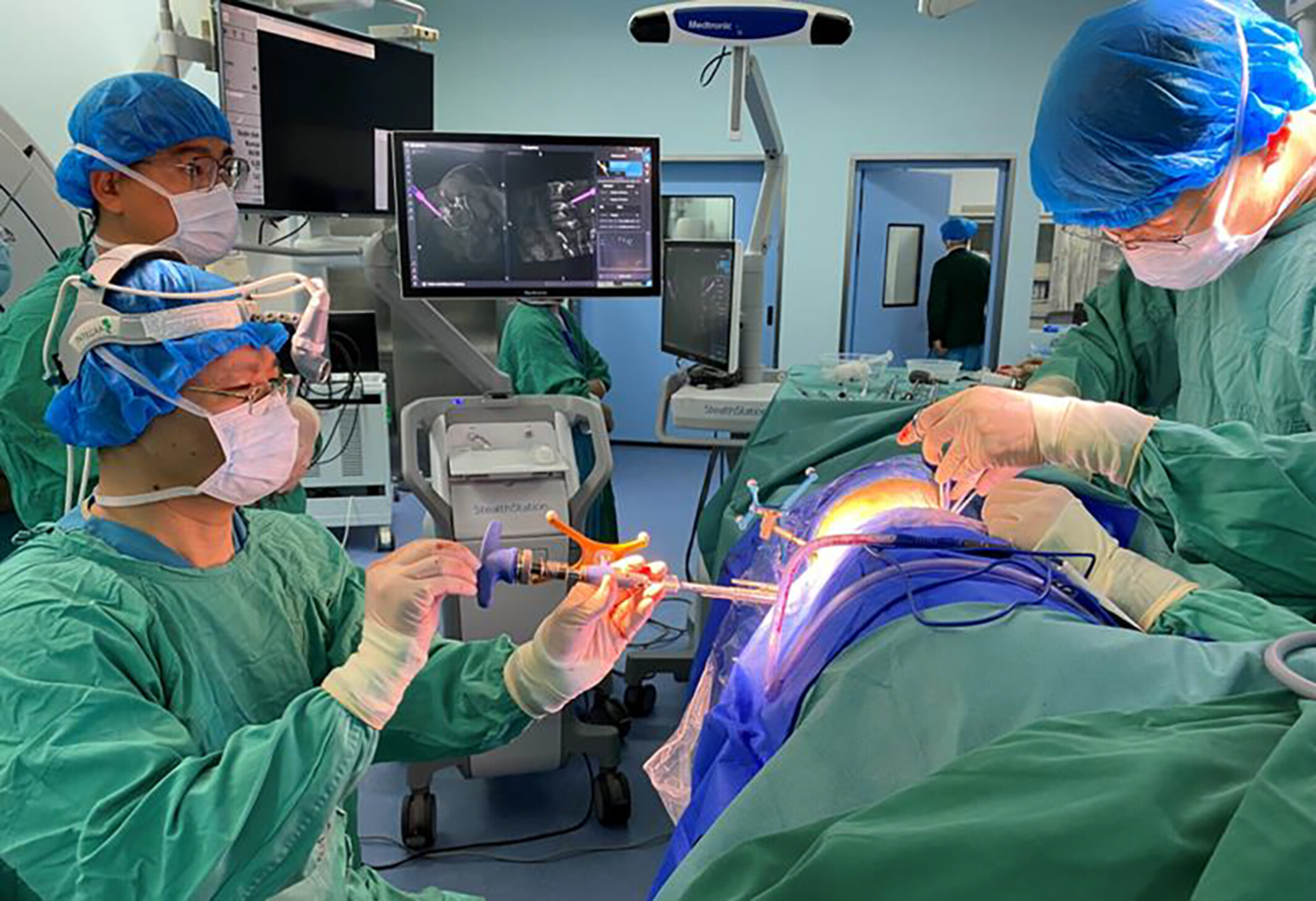 Simultaneous Single-Position Oblique Lumbar Interbody Fusion and Percutaneous Pedicle Screw Fixation under O-Arm Navigation for Modified MISDEF Type II Adult Degenerative Scoliosis: Case Series and Surgical Technique