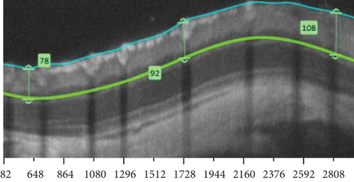 Details are in the caption following the image