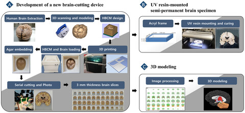 A new brain-cutting device and ultraviolet resin-mounted human brain slices as a teaching adjunct for neuroanatomy education