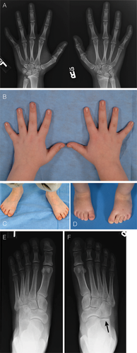 Details are in the caption following the image Details are in the caption following the image