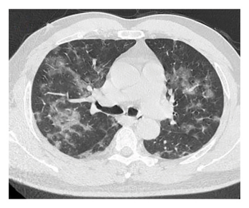 Details are in the caption following the image Details are in the caption following the image