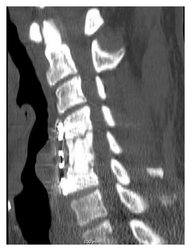 Details are in the caption following the image