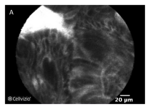 Details are in the caption following the image