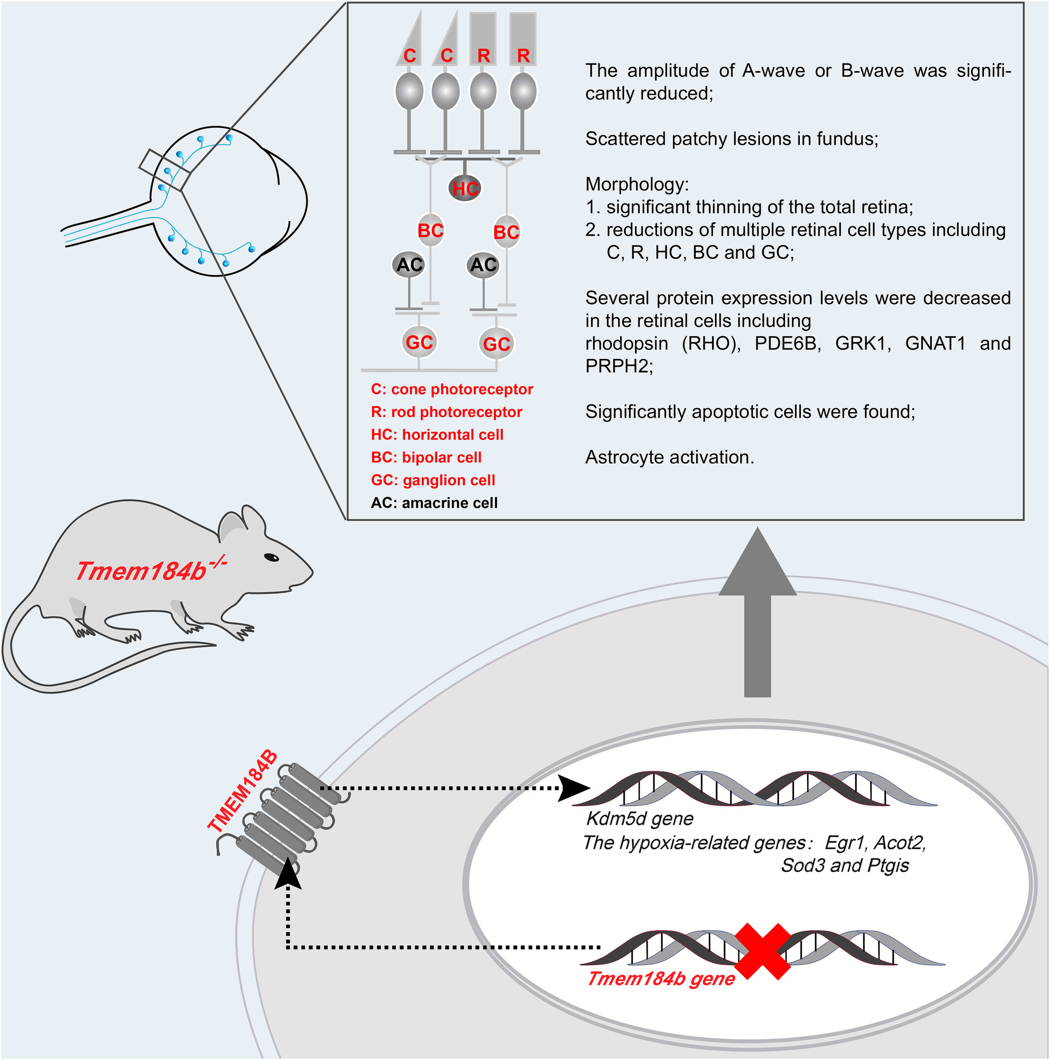 Deletion of Transmembrane protein 184b leads to retina degeneration in mice