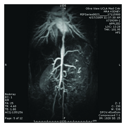 Details are in the caption following the image