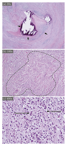 Details are in the caption following the image Details are in the caption following the image