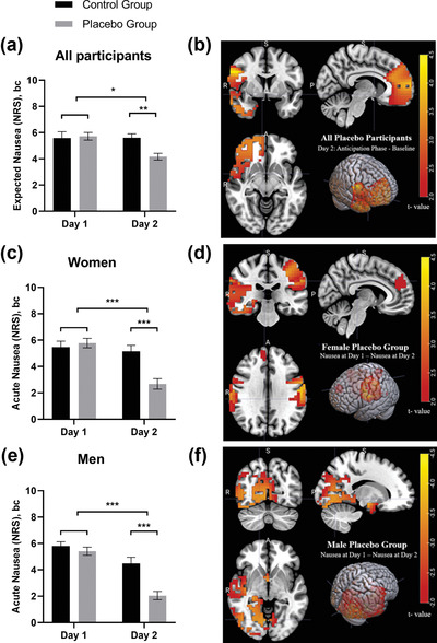 Central correlates of placebo effects in nausea differ between men and women