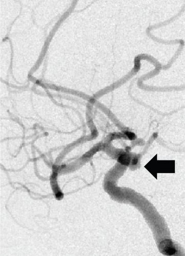 Details are in the caption following the image