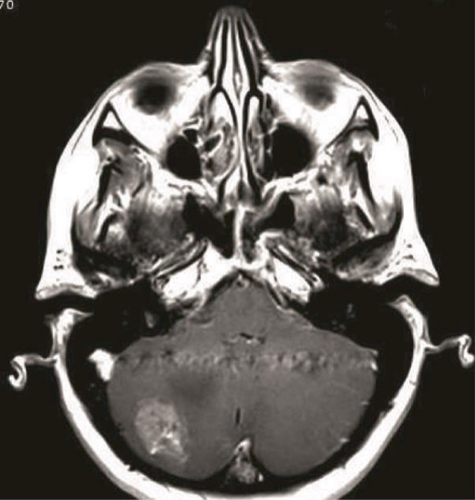 Details are in the caption following the image
