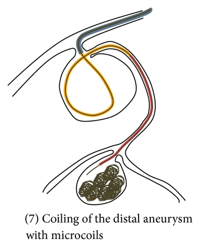Details are in the caption following the image