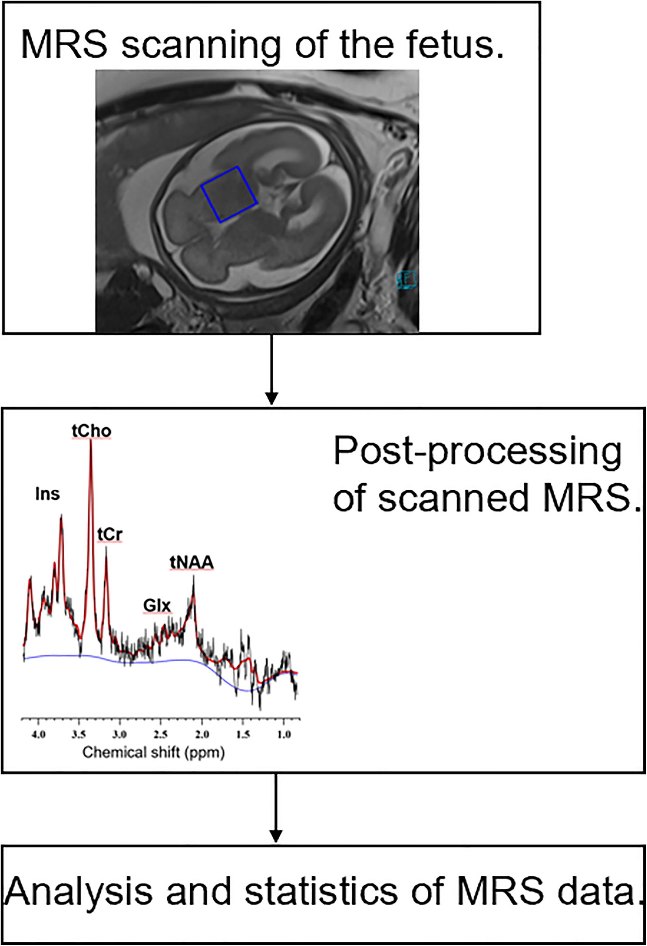 Value of Magnetic Resonance Spectroscopy for Examining Fetal Brain Development in Mid- to Late Pregnancy
