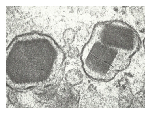 Details are in the caption following the image
