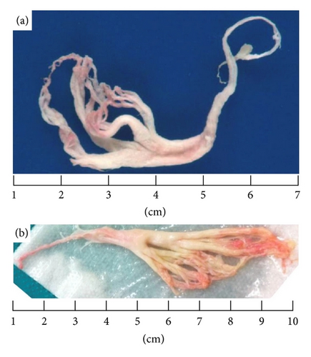 Details are in the caption following the image