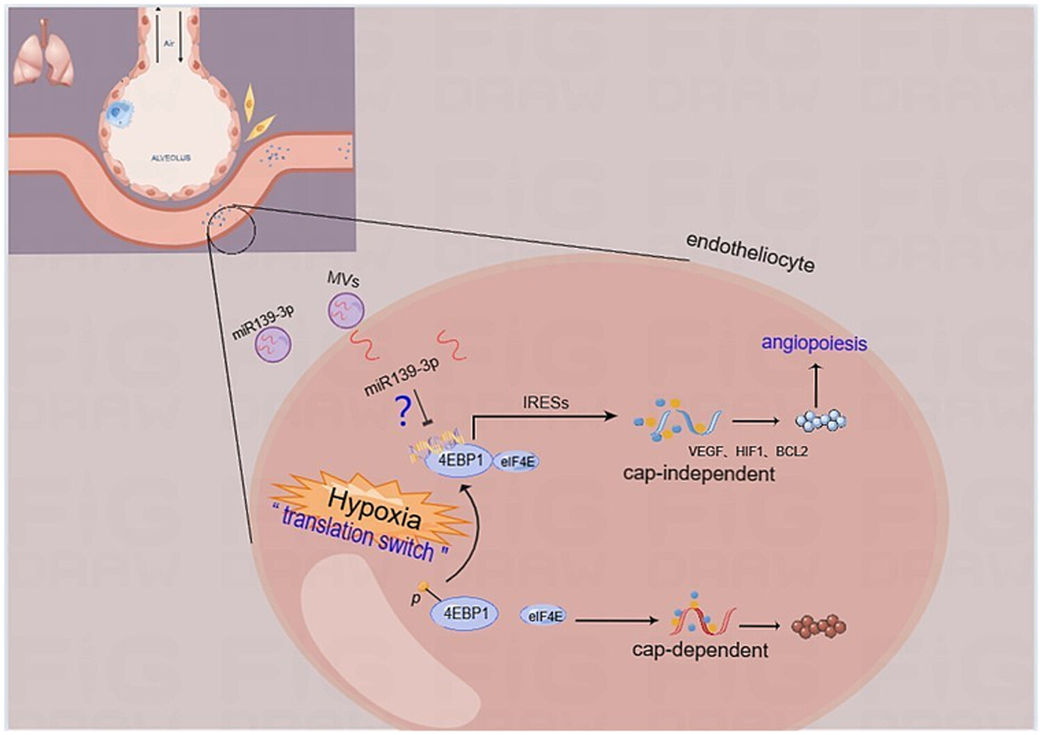 Circulating microvesicles miR139-3p from bronchopulmonary dysplasia aggravates pulmonary vascular simplification by targeting 4E binding protein 1