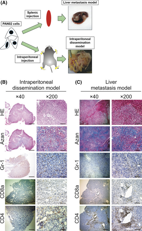 Distinct chemotherapy-associated anti-cancer immunity by myeloid cells inhibition in murine pancreatic cancer models