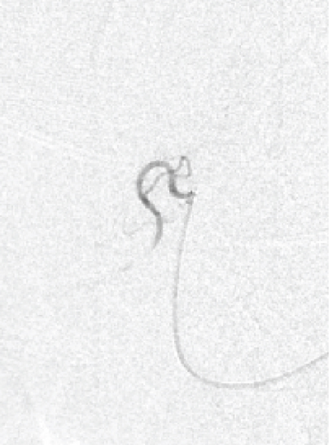 Details are in the caption following the image