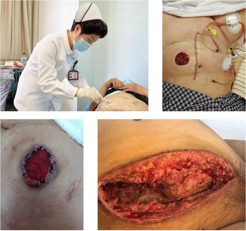 Details are in the caption following the image Details are in the caption following the image