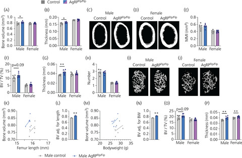 AgRP signalling negatively regulates bone mass