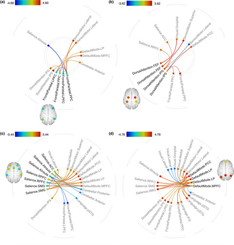 Inhibition of emotions in healthy aging: age-related differences in brain network connectivity