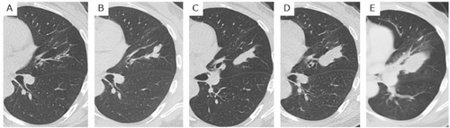 Details are in the caption following the image Details are in the caption following the image