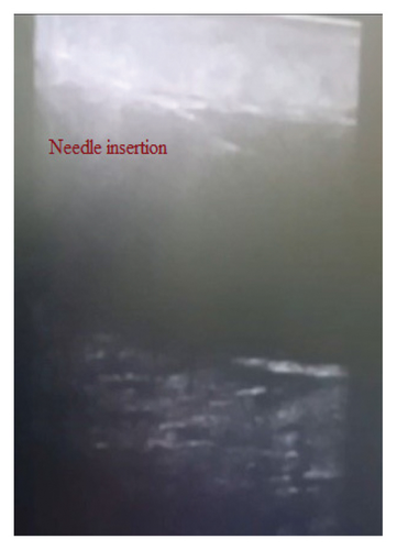 Details are in the caption following the image