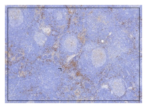 Details are in the caption following the image