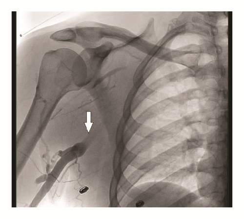Details are in the caption following the image