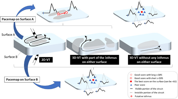 Temporal and spatial pacemap parameters for identification of cardiac surfaces with critical sites for ventricular tachycardia