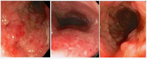 Details are in the caption following the image Details are in the caption following the image